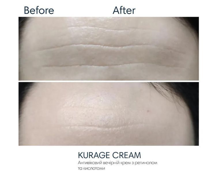 Нічний крем з кислотами та ретинолом Braderm Kurage Cream 2323233 фото
